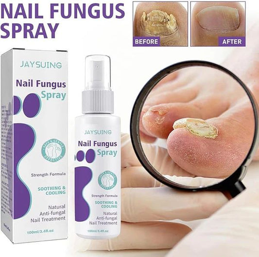 Nail Fungus Spray | بخاخ علاج فطريات الأظافر