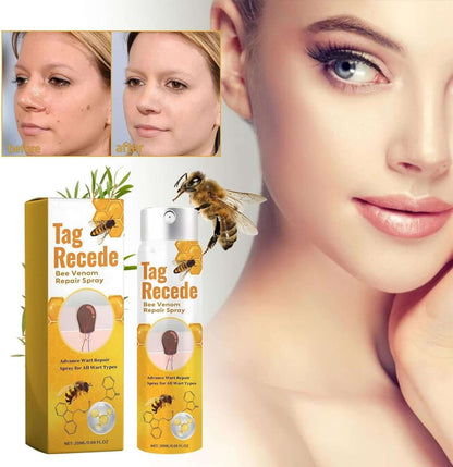 Tag Recede Bees Treatment Spray | بخاخ علاج لسعات/نحل P-Venom