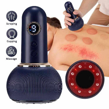 Smart Electric Vacuum Suction Scraping Therapy Massager | جهاز التدليك بالشفط والعلاج الذكي