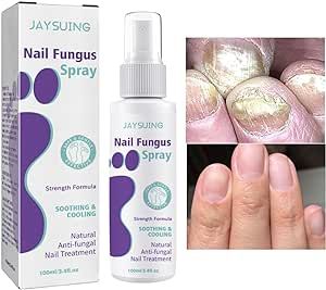 Nail Fungus Spray | بخاخ علاج فطريات الأظافر