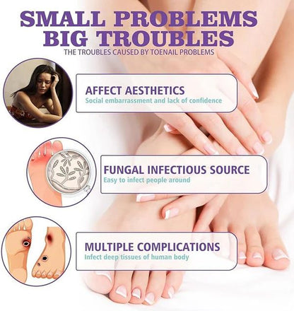 Nail Fungus Spray | بخاخ علاج فطريات الأظافر