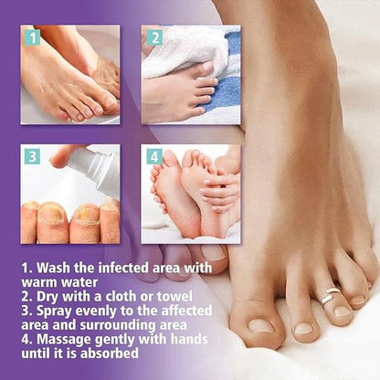 Nail Fungus Spray | بخاخ علاج فطريات الأظافر